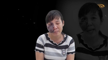 25 năm sống trong bóng tối và cuộc gặp gỡ với bác sĩ Hoàng Tuấn – Khi y đức mở ra một cuộc đời mới